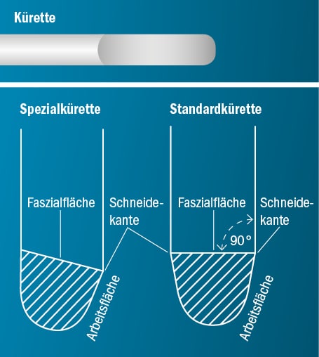 Spitzen Aufbau Kürette Spitzen Aufbau Kürette