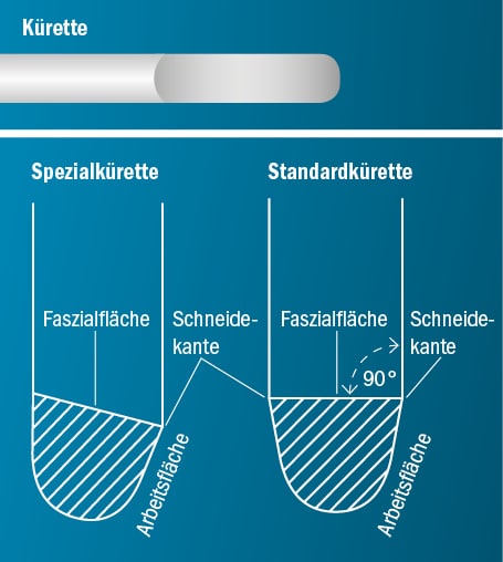 Spitzen Aufbau Kürette