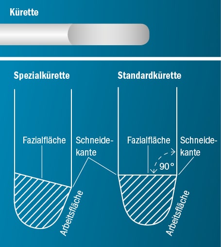 spitzen_aufbau Spitzen Aufbau Kürette